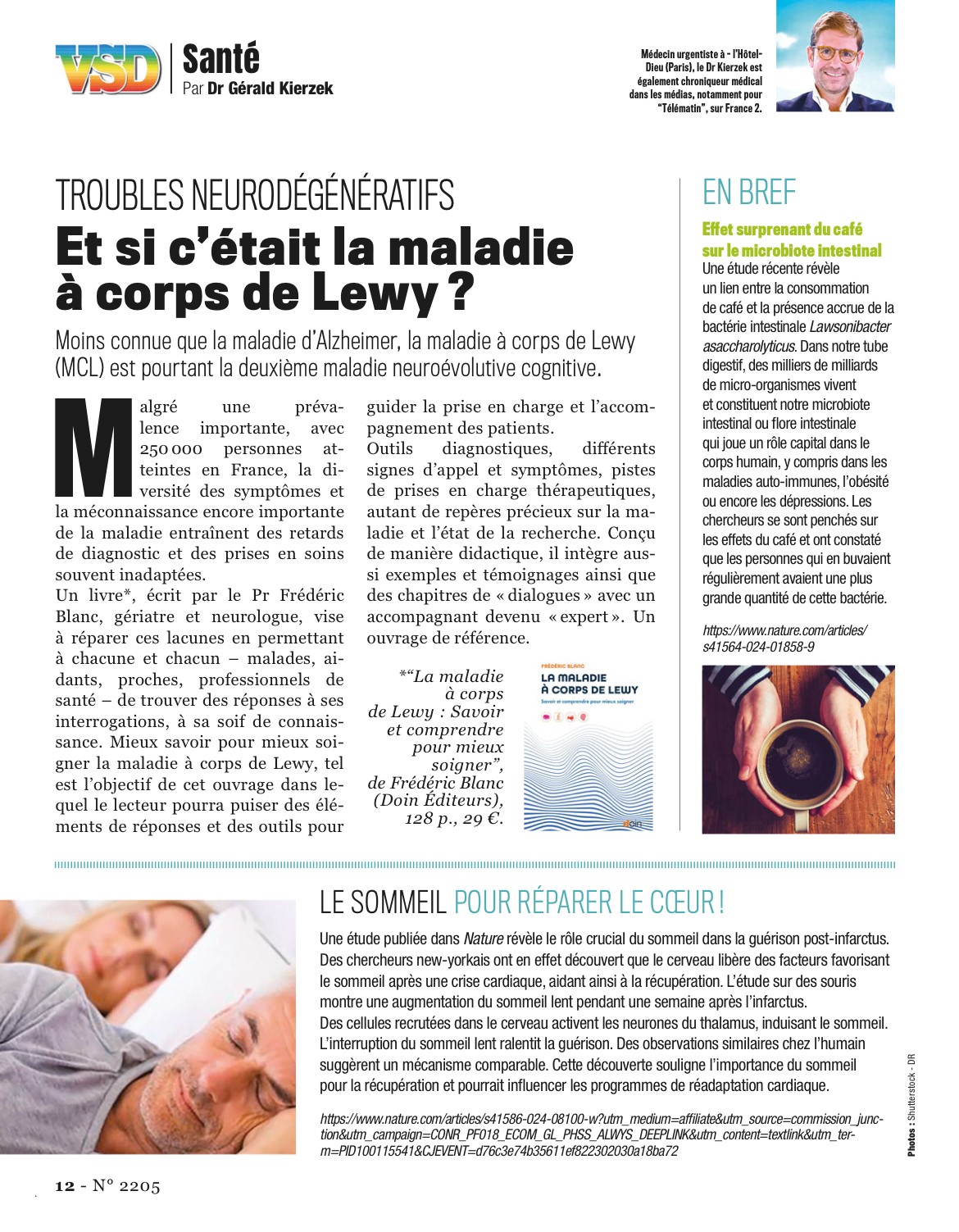 Et si c’était la maladie à corps de Lewy ?